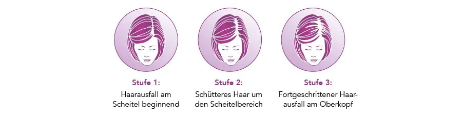 Haarverlustbereiche